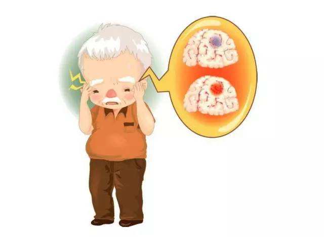 脑出血的预防不要忽视这些事情