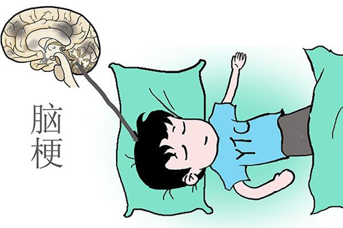 经颅磁刺激技术_对于脑梗塞患者怎么护理好