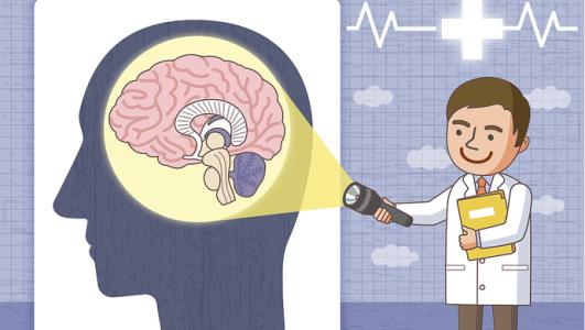 经颅磁刺激仪真的有用吗?癫痫病发作种类有什么