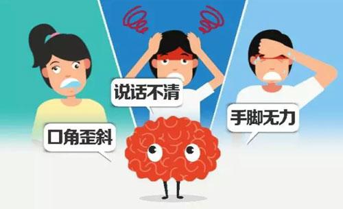 经颅磁刺激仪的功效如何?脑卒中的六大表现