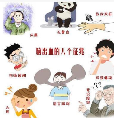 家用经颅磁刺激仪_脑出血的治疗原则是什么