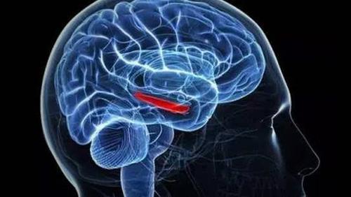 择思达斯经颅磁——脑血栓如何康复训练 
