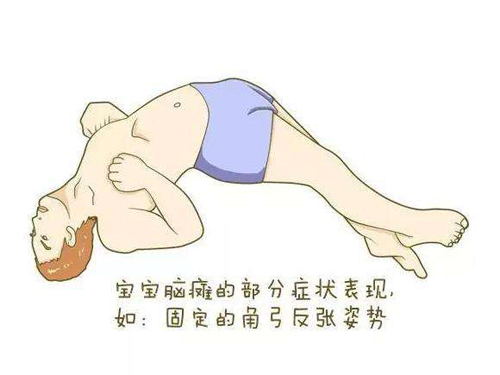 经颅磁治疗什么疾病_脑瘫有什么危害和后果