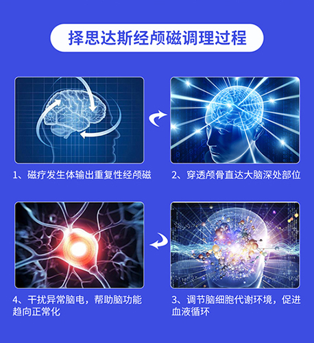 择思达斯经颅磁刺激仪物理治疗设备 