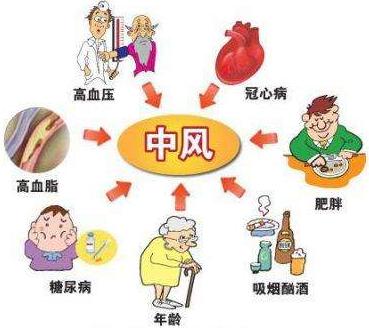 择思达斯是三无产品吗?脑中风前兆是什么怎么样